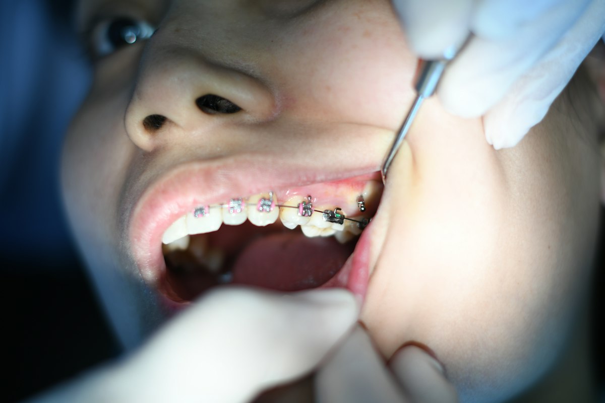 Ortodoncia con brackets