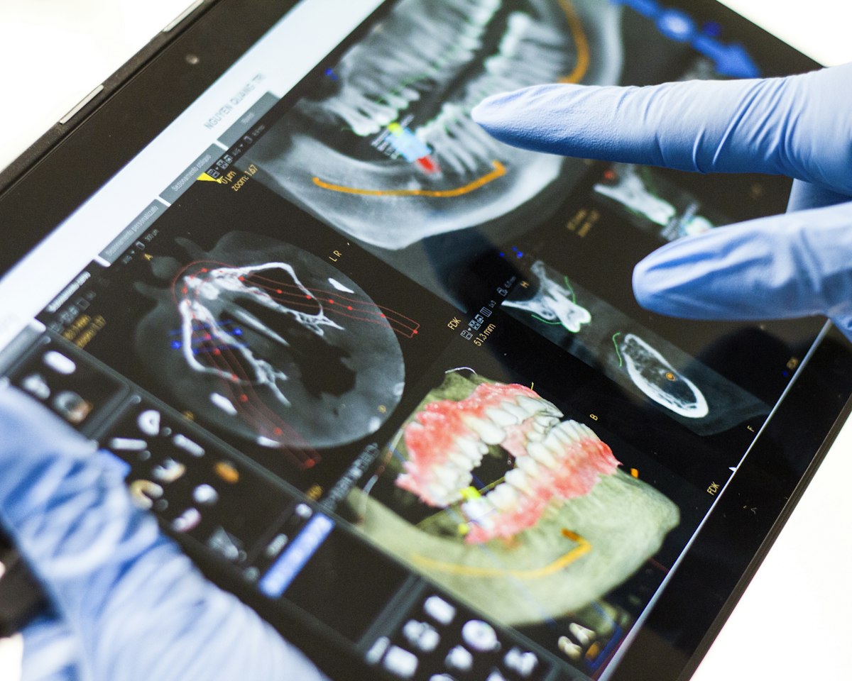 Planificación digital de un tratamiento dental en 3D